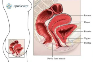 Treatment For A Leaky Bladder 2 How EM Chair treatment Heanor can help Leaky bladder issues. Read more now!