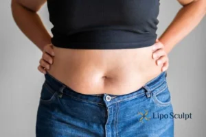 Bidding Farewell to Muffin Tops with Aqualyx Fat Injections 2 Do you wish you could reduce your muffin top Heanor With Aqualy fat dissolving injections you can!